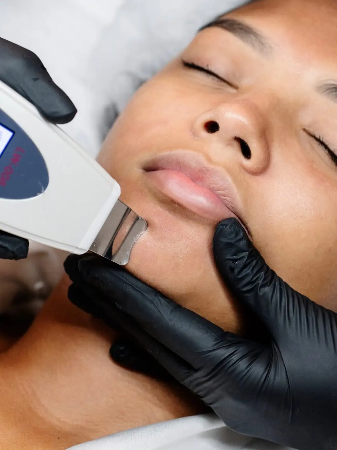 Limpieza facial especializada