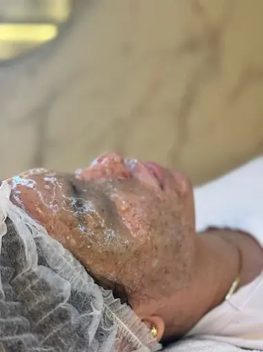 Mascarilla facial profesional